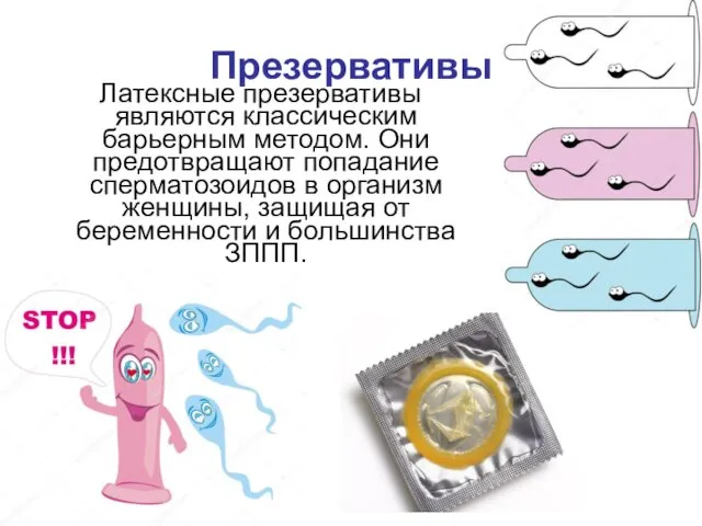 Презервативы Латексные презервативы являются классическим барьерным методом. Они предотвращают попадание сперматозоидов