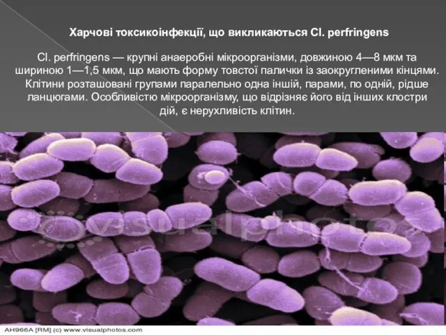 Харчові токсикоінфекції, що викликаються Cl. perfringens Cl. perfringens — крупні анаеробні