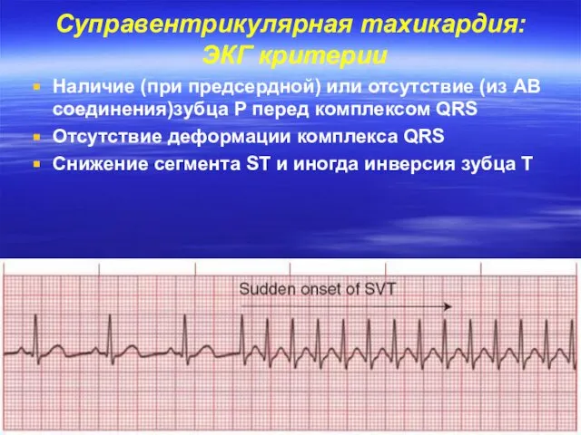 Суправентрикулярная тахикардия: ЭКГ критерии Наличие (при предсердной) или отсутствие (из АВ