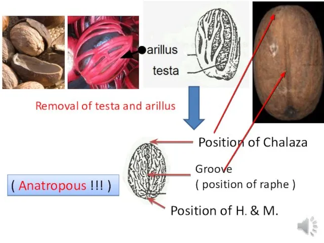 Groove ( position of raphe ) Position of H. & M.