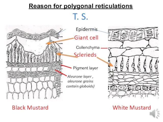 Sclerieds Giant cell Black Mustard White Mustard T. S. Epidermis Pigment