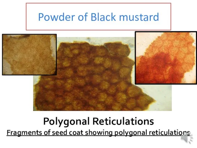 Powder of Black mustard Polygonal Reticulations Fragments of seed coat showing polygonal reticulations