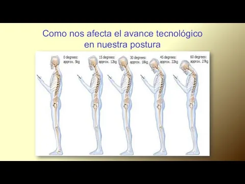 Como nos afecta el avance tecnológico en nuestra postura