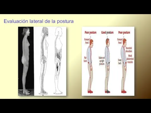 Evaluación lateral de la postura.