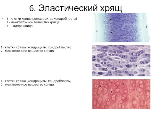 6. Эластический хрящ 1 - клетки хряща (хондроциты, хондробласты) 2 -