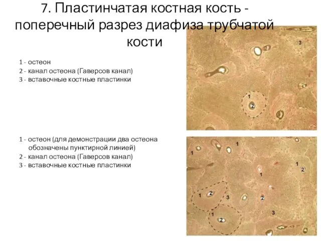 7. Пластинчатая костная кость - поперечный разрез диафиза трубчатой кости 1