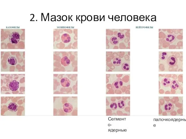 2. Мазок крови человека палочкоядерные Сегменто- ядерные