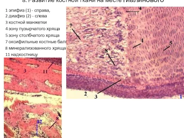 8. Развитие костной ткани на месте гиалинового хряща 1 эпифиз (1)