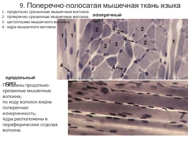 9. Поперечно-полосатая мышечная ткань языка 1 - продольно-срезанные мышечные волокна 2