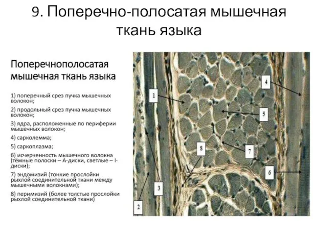 9. Поперечно-полосатая мышечная ткань языка