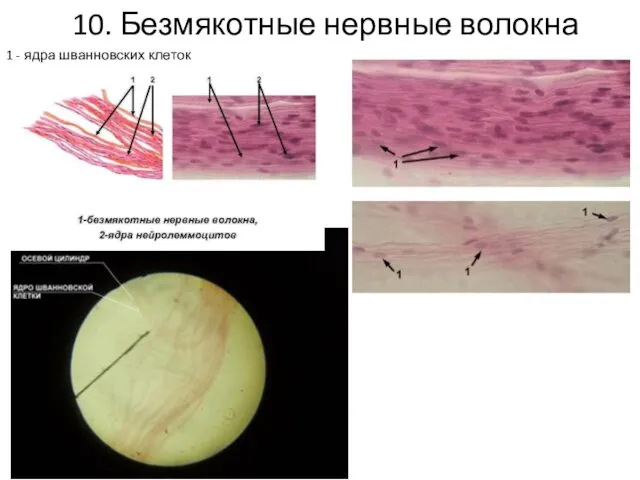 10. Безмякотные нервные волокна 1 - ядра шванновских клеток