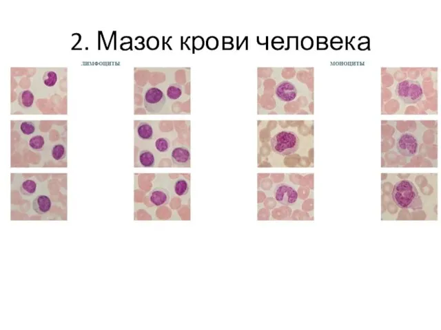 2. Мазок крови человека