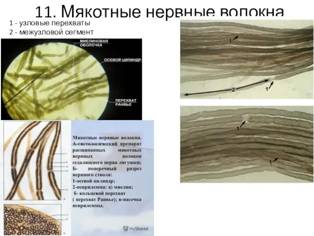 11. Мякотные нервные волокна 1 - узловые перехваты 2 - межузловой сегмент