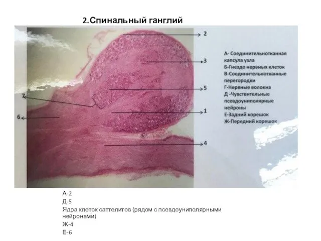 2.Спинальный ганглий А-2 Д-5 Ядра клеток саттелитов (рядом с псевдоуниполярными нейронами) Ж-4 Е-6