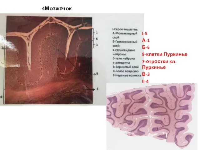 4Мозжечок I-5 А-1 Б-6 9-клетки Пуркинье 7-отростки кл. Пуркинье В-3 II-4
