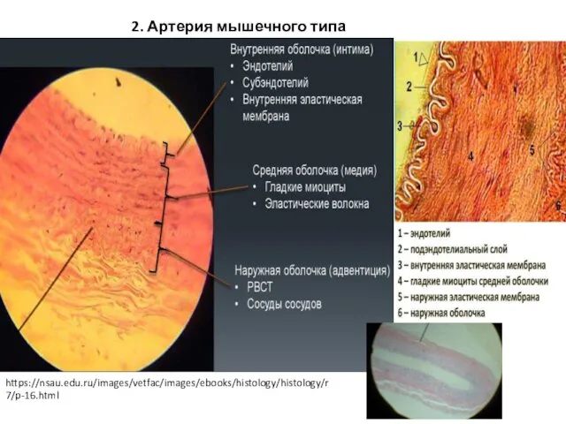 2. Артерия мышечного типа https://nsau.edu.ru/images/vetfac/images/ebooks/histology/histology/r7/p-16.html