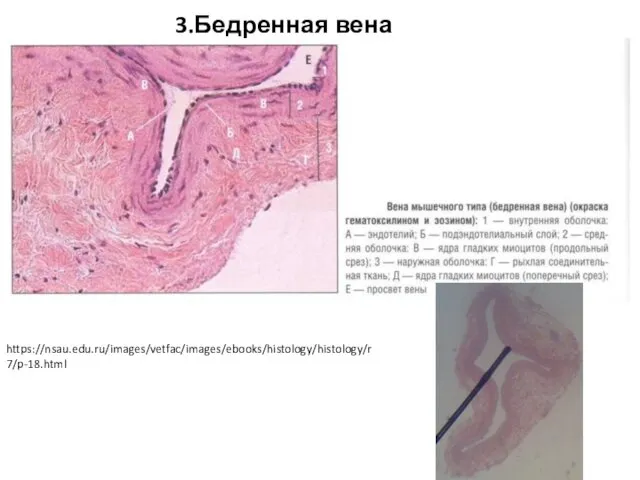 3.Бедренная вена https://nsau.edu.ru/images/vetfac/images/ebooks/histology/histology/r7/p-18.html