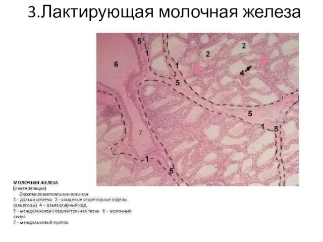 3.Лактирующая молочная железа