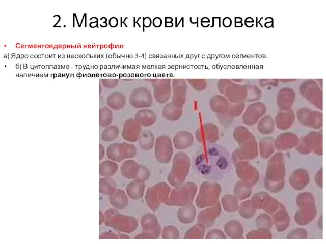 2. Мазок крови человека Сегментоядерный нейтрофил а) Ядро состоит из нескольких