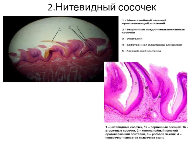 2.Нитевидный сосочек