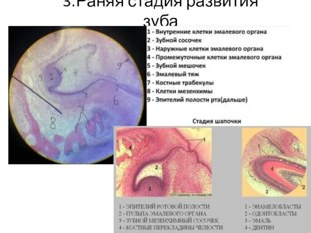 3.Раняя стадия развития зуба