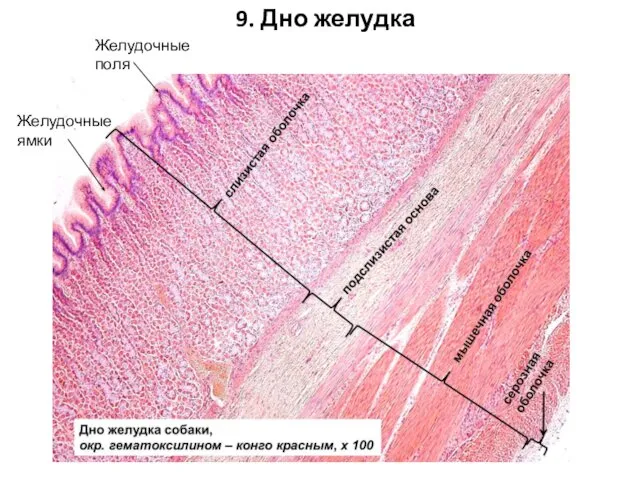 9. Дно желудка Желудочные поля Желудочные ямки