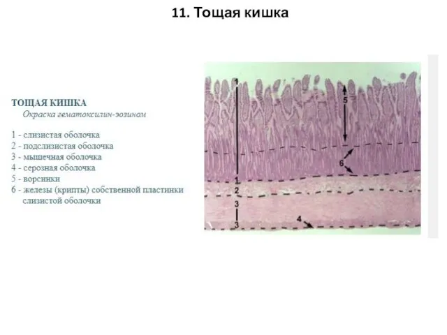 11. Тощая кишка