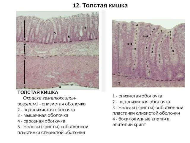 12. Толстая кишка ТОЛСТАЯ КИШКА Окраска гематоксилин-эозином1 - слизистая оболочка 2