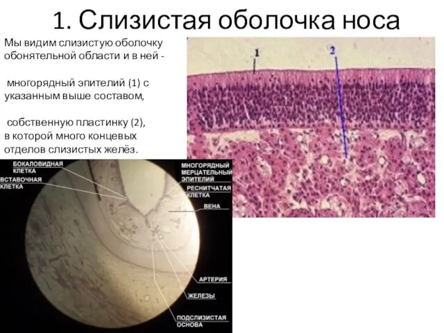 1. Слизистая оболочка носа Мы видим слизистую оболочку обонятельной области и