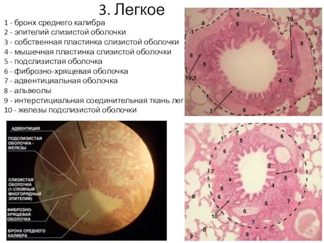 3. Легкое 1 - бронх среднего калибра 2 - эпителий слизистой