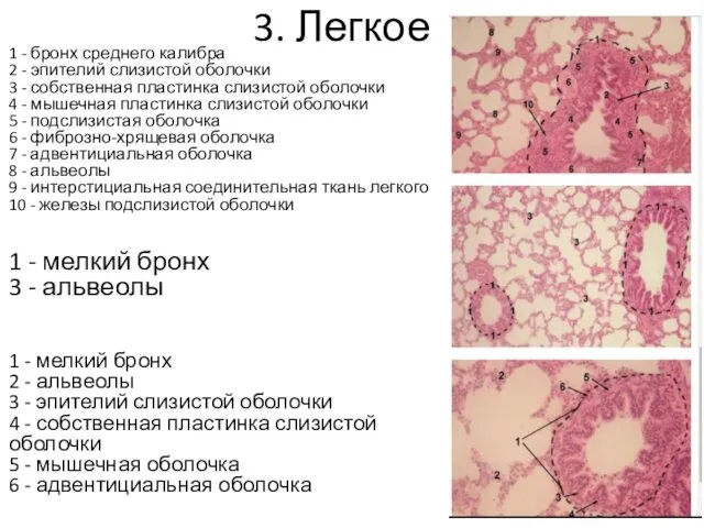 3. Легкое 1 - бронх среднего калибра 2 - эпителий слизистой