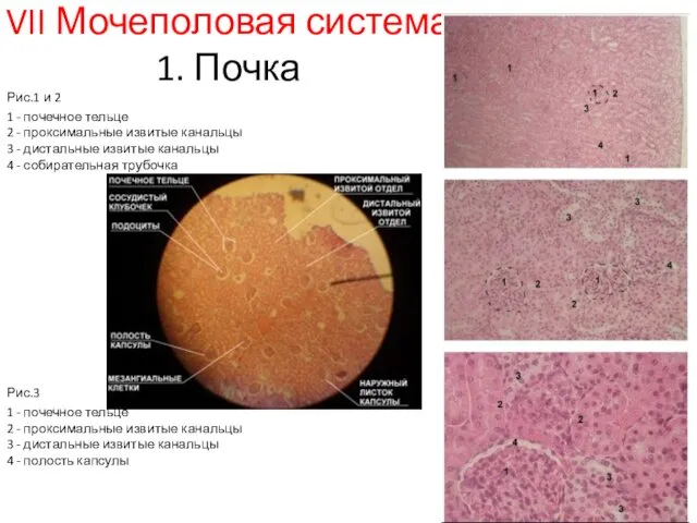 VII Мочеполовая система 1. Почка Рис.1 и 2 1 - почечное