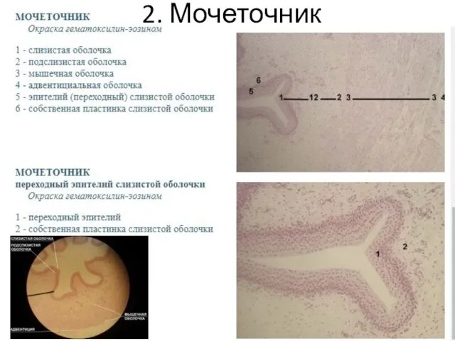 2. Мочеточник