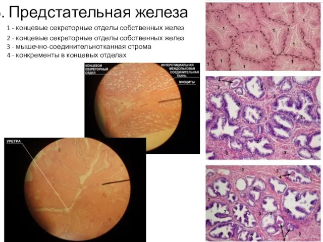 6. Предстательная железа 1 - концевые секреторные отделы собственных желез 2