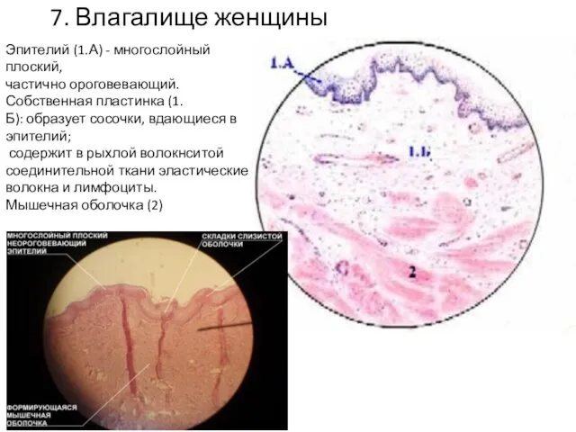 7. Влагалище женщины Эпителий (1.А) - многослойный плоский, частично ороговевающий. Собственная