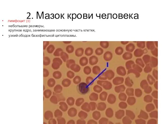 2. Мазок крови человека лимфоцит (1) небольшие размеры, крупное ядро, занимающее