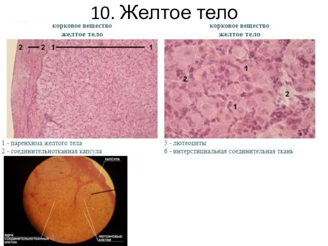 10. Желтое тело