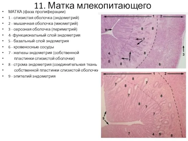 11. Матка млекопитающего МАТКА (фаза пролиферации) 1 - слизистая оболочка (эндометрий)