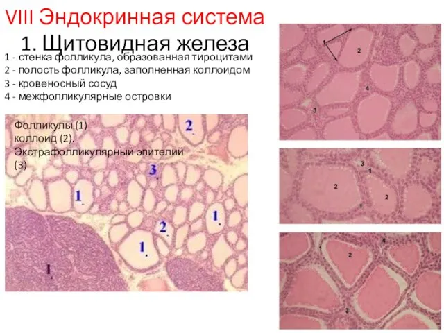 VIII Эндокринная система 1. Щитовидная железа 1 - стенка фолликула, образованная