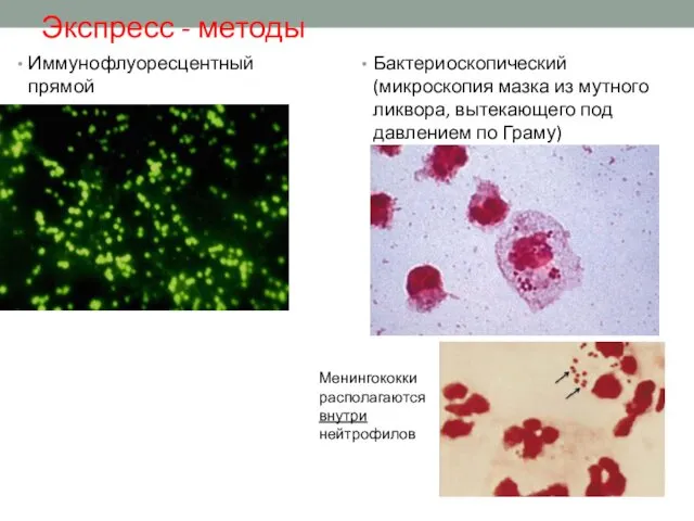 Экспресс - методы Бактериоскопический (микроскопия мазка из мутного ликвора, вытекающего под