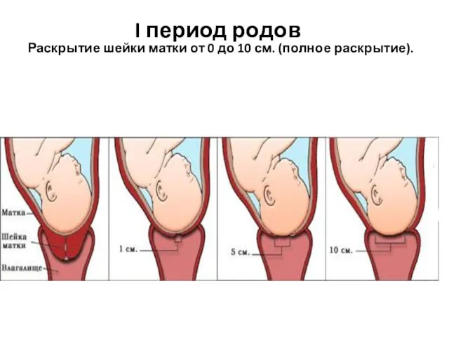 I период родов Раскрытие шейки матки от 0 до 10 см. (полное раскрытие).
