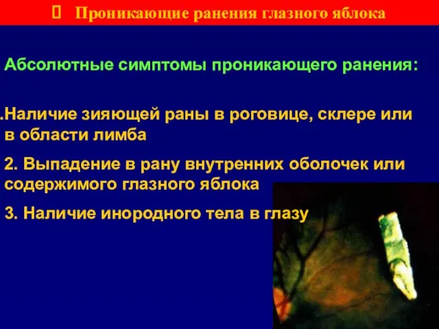 Проникающие ранения глазного яблока Абсолютные симптомы проникающего ранения: Наличие зияющей раны