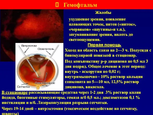 Первая помощь Гемофтальм В стационаре рассасывающие средства через 1-2 дня 3%