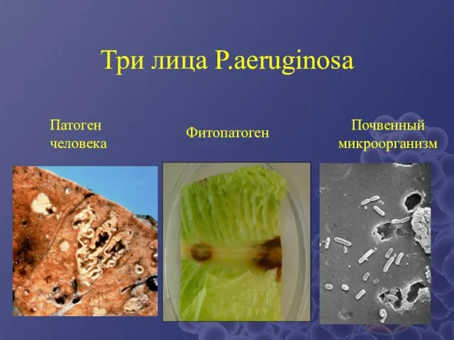 Три лица P.aeruginosa Патоген человека Фитопатоген Почвенный микроорганизм