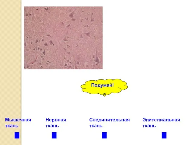 Нервная ткань Эпителиальная ткань Соединительная ткань Мышечная ткань Подумай!