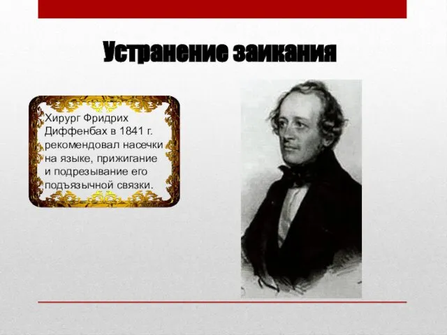 Устранение заикания Хирург Фридрих Диффенбах в 1841 г. рекомендовал насечки на