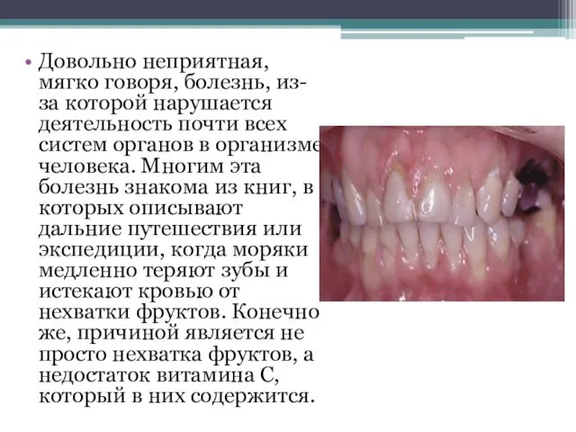 Довольно неприятная, мягко говоря, болезнь, из-за которой нарушается деятельность почти всех