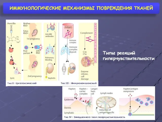 ИММУНОЛОГИЧЕСКИЕ МЕХАНИЗМЫ ПОВРЕЖДЕНИЯ ТКАНЕЙ Типы реакций гиперчувствительности Тип II : Цитотоксический