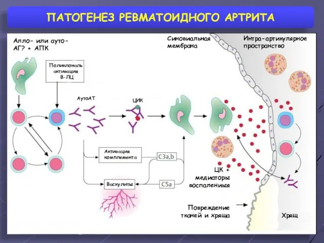 ПАТОГЕНЕЗ РЕВМАТОИДНОГО АРТРИТА Синовиальная мембрана Интра-артикулярное пространство Алло- или ауто- АГ?