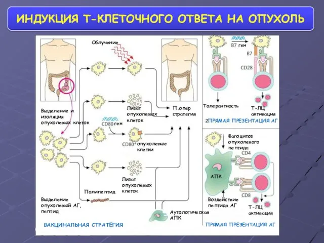 ИНДУКЦИЯ Т-КЛЕТОЧНОГО ОТВЕТА НА ОПУХОЛЬ Выделение и изоляция опухолевых клеток Выделение